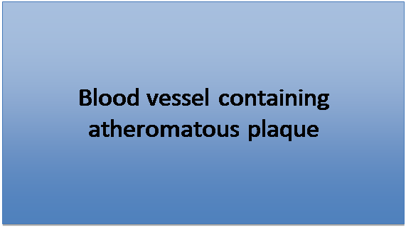 Text Box: Blood vessel containing atheromatous plaque