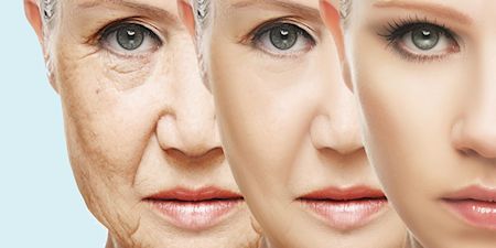 Aging skin