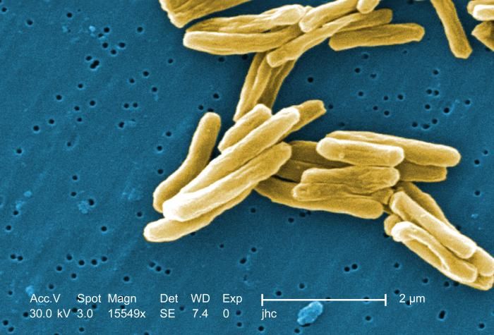 TB bacillus
