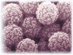 Large colloid particles aggregated onto smaller ones