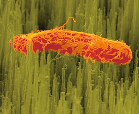 False-colour e-coli bacterium on a black silicon surface.