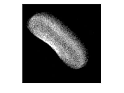 2D NMR image