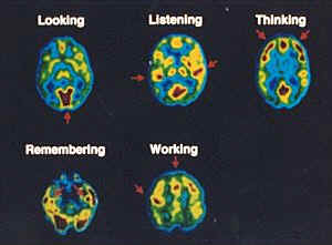 Areas of the brain involved in speciffic functions (used without permission)