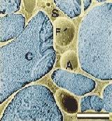 electron micrograph of ice cream