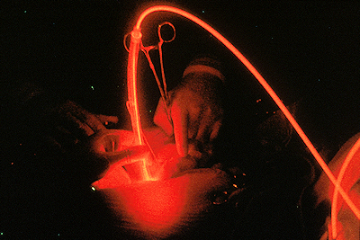 Photodynamic Therapy