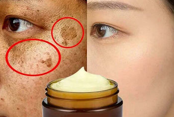 Whitening cream