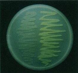 E coli