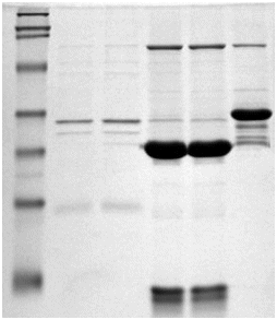 SLS-PAGE electrophoresis