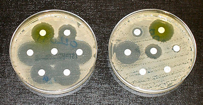 AMR test