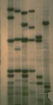 A DNA Fingerprint