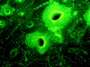 Tetracycline Nubian bone fluorescence