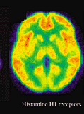 PET scan of H1 receptors in the brain