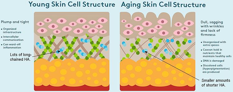 Cartoon of the structure of the skin