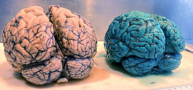Blue brain
