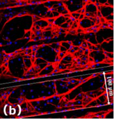 Neurons on Patterned diamond