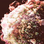 HIV