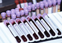 Blood samples